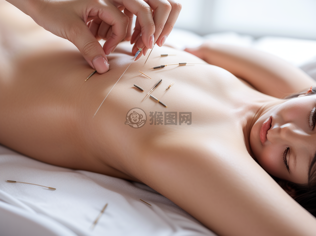 针灸治疗中病人躺床上的照片